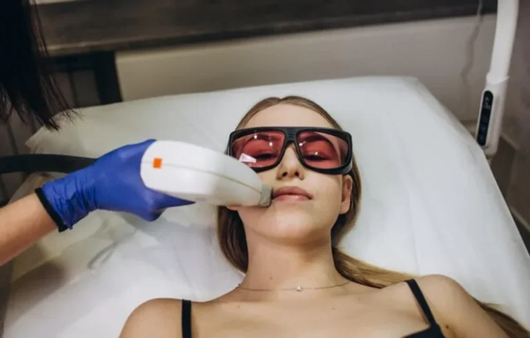 sbiancamento laser